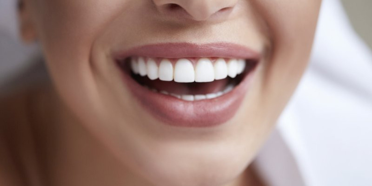 The Importance of Regular Dental Checkups for a Healthy Smile