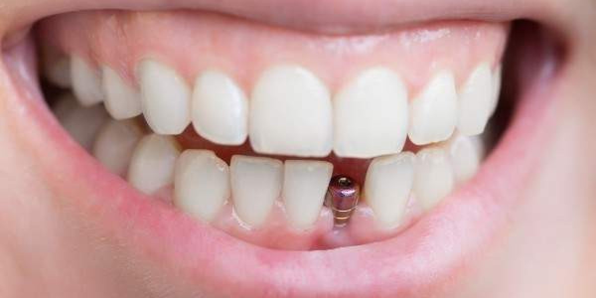 What Causes Bad Breath? Advice from Newtownabbey Clinics