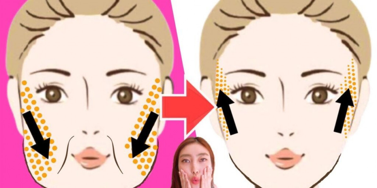 How to Identify and Address Marionette Lines Early